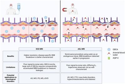 Imaging blood–brain barrier disruption in neuroinflammation and Alzheimer’s disease